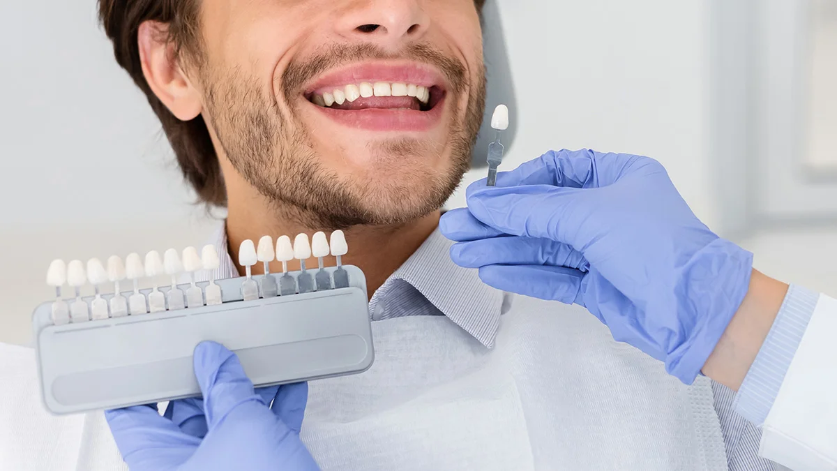 Dentist applying sample from tooth scale to smiling man teeth Veneers | Somerset Dental on James
