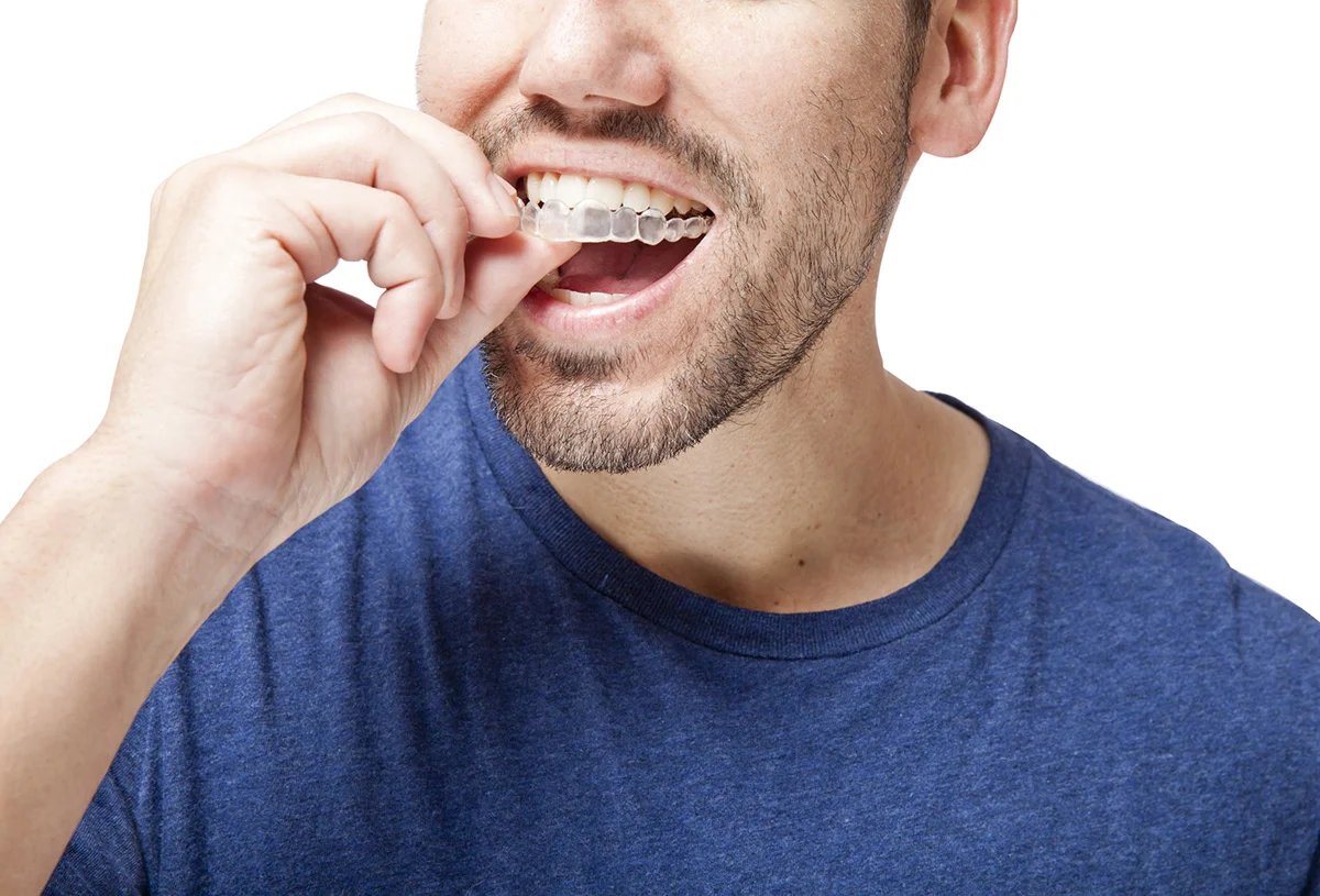 Clear Braces Man Invisalign | Somerset Dental on James