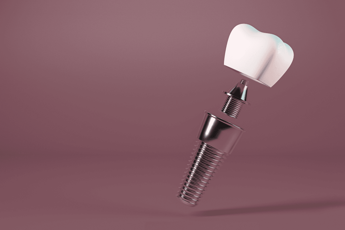 A 3D illustration showing the three components of a dental implant: the titanium post, abutment, and ceramic crown, separated against a neutral background.