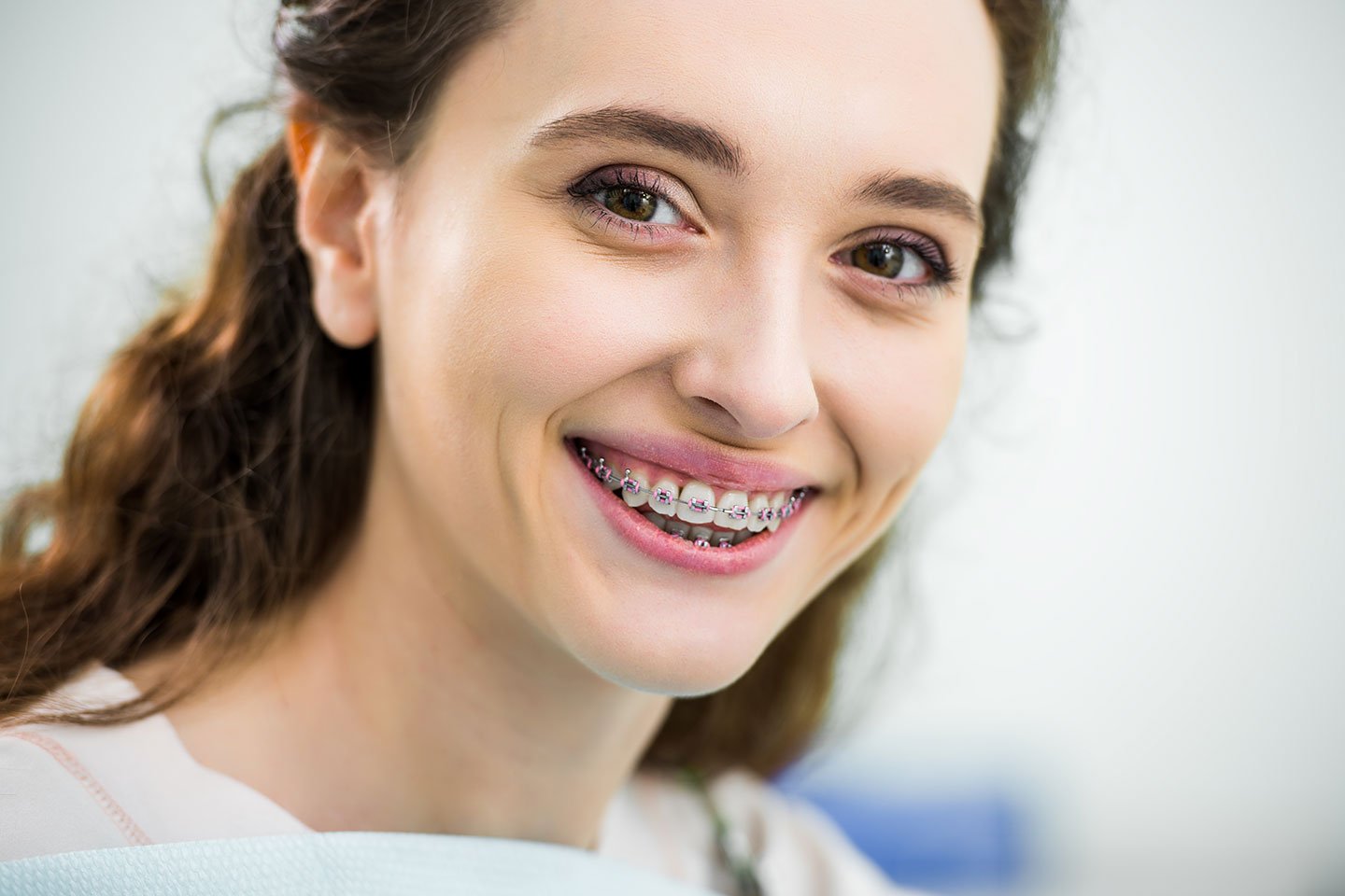 dental braces