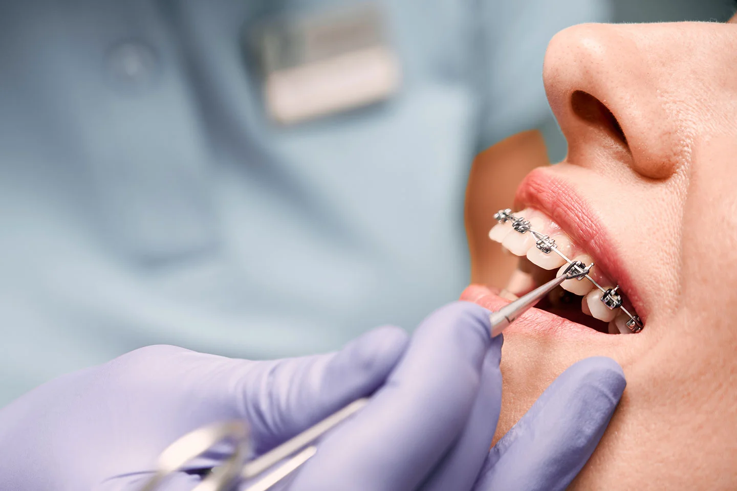 What Are The Benefits Of Orthodontic Treatment?