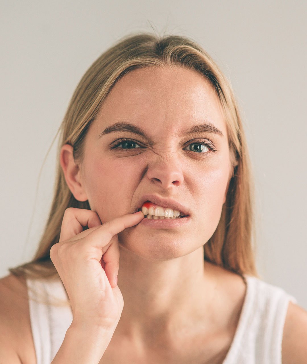 woman-suffering-toothache-gum-bleeding