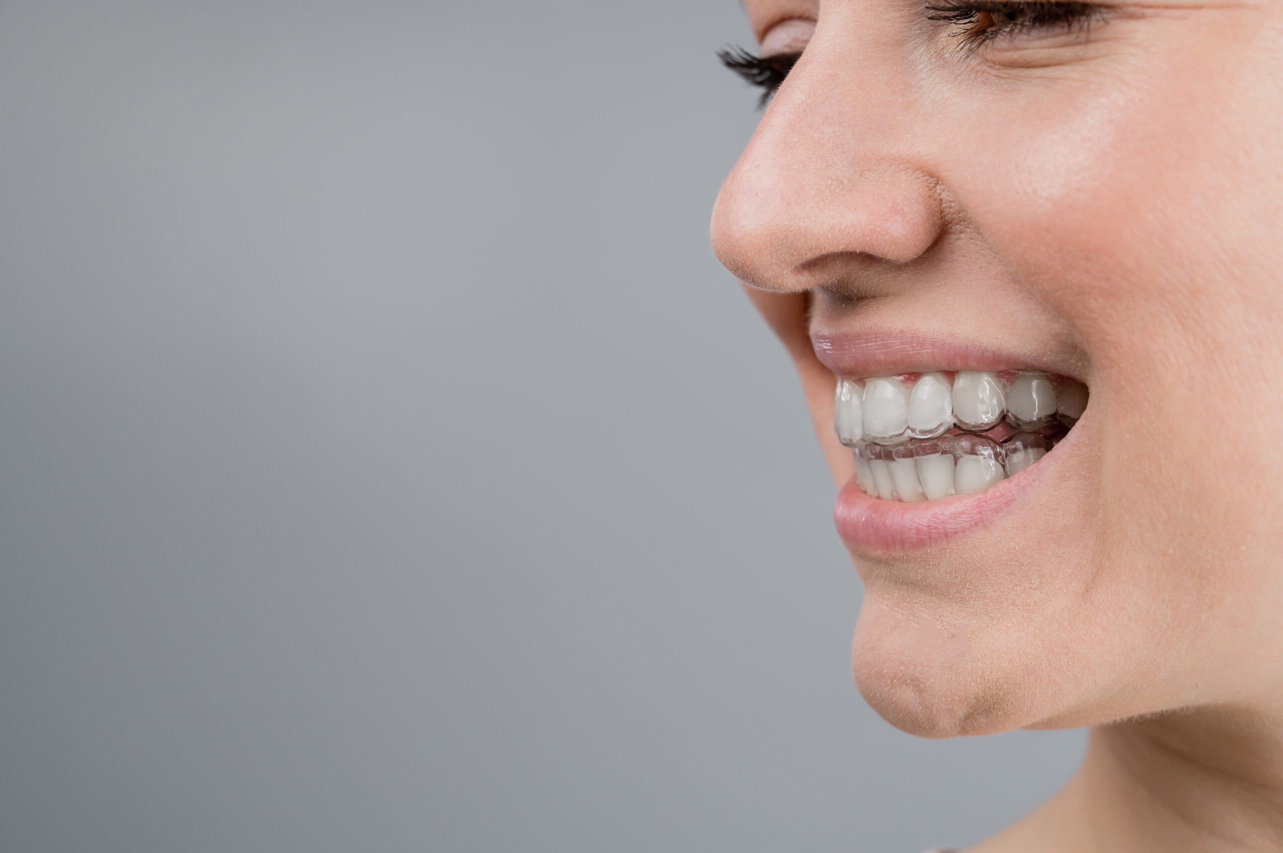Trends in Cosmetic Dentistry