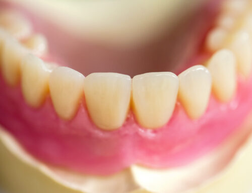 Strategies for Preventing Tartar Buildup on Teeth