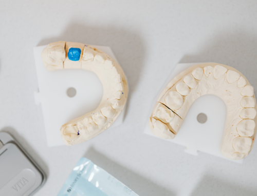 Understanding the Types of Dental Crowns: Pros, Cons, and How to Choose