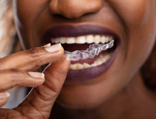 Invisalign vs. Braces: What’s the Best Choice for You?