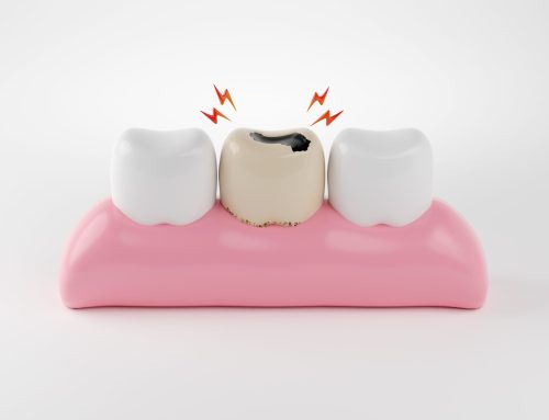 Toothaches to Gum Disease: Your Guide to Common Oral Health Problems