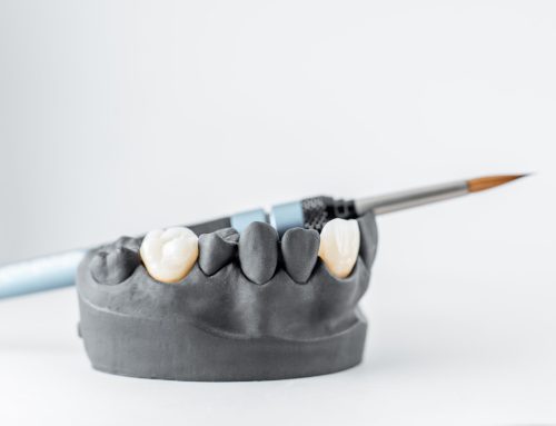 Same-Day Crowns in Calgary: Convenience Without Compromise