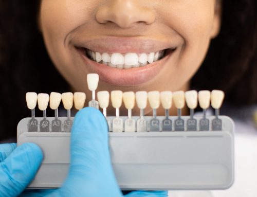 The Truth About Teeth Whitening: Myths vs. Reality