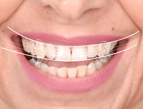 Your Digital Smile Design Consultation: What to Expect
