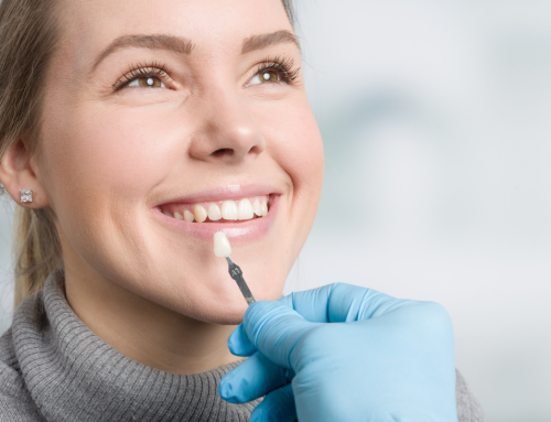 Porcelain Veneers: How to Know If They’re Right for Your Smile